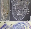 Afbeeldingsresultaten voor "rhynchonerella Gracilis". Grootte: 105 x 100. Bron: www.researchgate.net