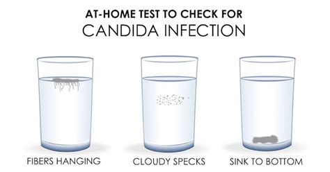 candida overgrowth complete guide on treating a candida infection