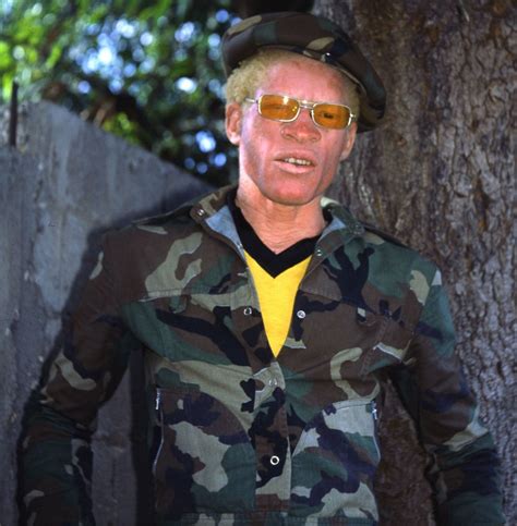 recalling yellowman s journey from an abandoned jamaican albino to the