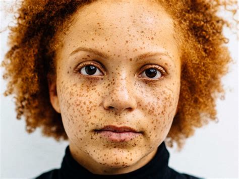 Photographer Challenges Perception Of Redheads With