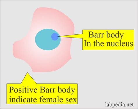 Barr Bodies Detection Sex Chromatin Body Nuclear Sexing And