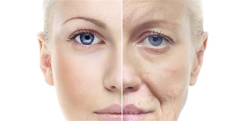 signs  aging  inflammation cutis laser clinics