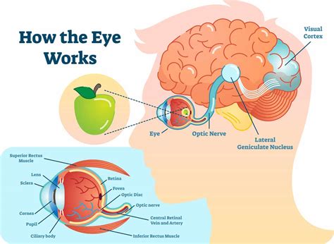 cortical visual impairment lawsuit pritzker hageman pa