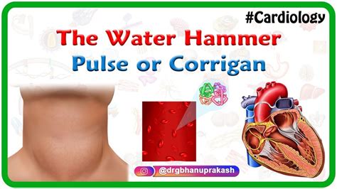 water hammer pulse  corrigan hyperkinetic pulse usmle cardiology youtube