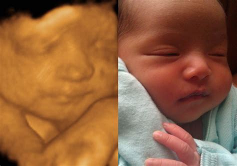 ultrasound baby   hd ultrasound virginia
