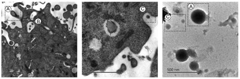 extracellular vesicles in mesenchymal stromal cells a novel