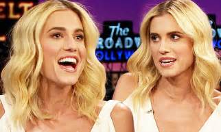 allison williams says she gets more attention as a blonde daily mail