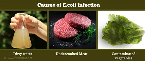 E Coli Infection Escherichia Coli Infection Causes