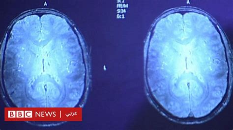 كيف يعمل دماغ الانسان أثناء الضجيج؟ bbc news عربي