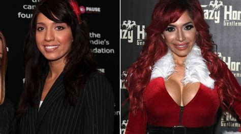 reality stars before and after plastic surgery looks