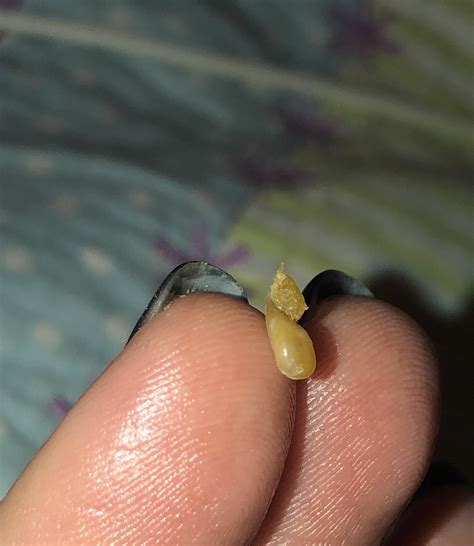 scratched a bump inside my ear and this came out r popping