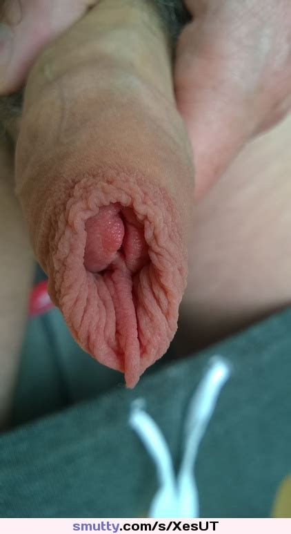 uncut foreskin frenulum meatus