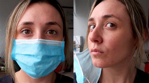 coronavirus pandemic causing skin issue mask ne aka mask acne glam