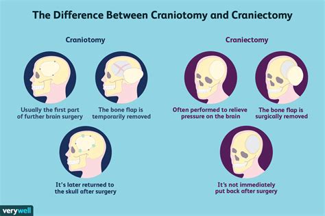 craniectomy procedure risks  recovery time
