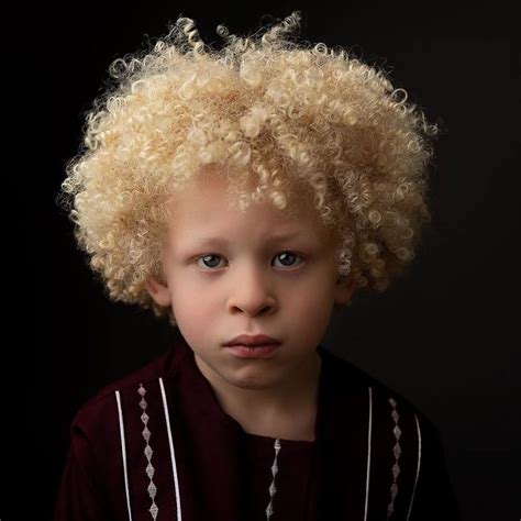 year  albino boy  model  primark  mum shares