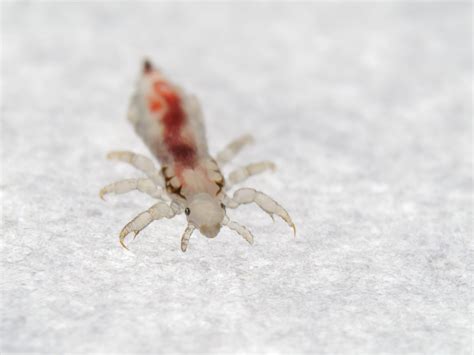 prevent head lice  bugging  health journal