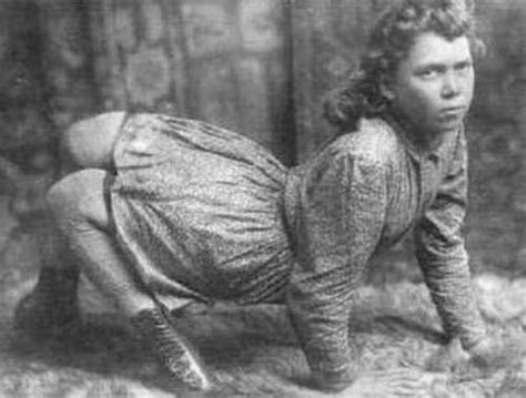 The Most Famous Circus Freaks From Sideshow History