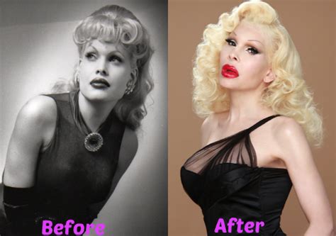 Amanda Lepore As A Man Before And After Plastic Surgery