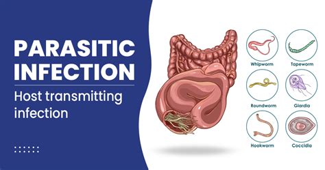 What Is A Parasitic Infection