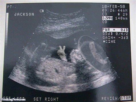 funny ultrasound pictures freaking news