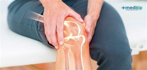 Osteoartritis O Artrosis Causas Síntomas Y Tratamiento