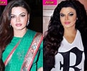 Image result for Rakhi Sawant Before and After Surgery. Size: 122 x 100. Source: plasticsurgerystar.org