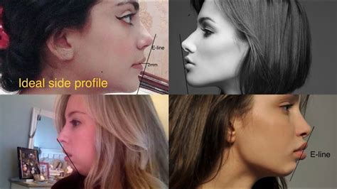 improve side profile  exercise  ideal attractive
