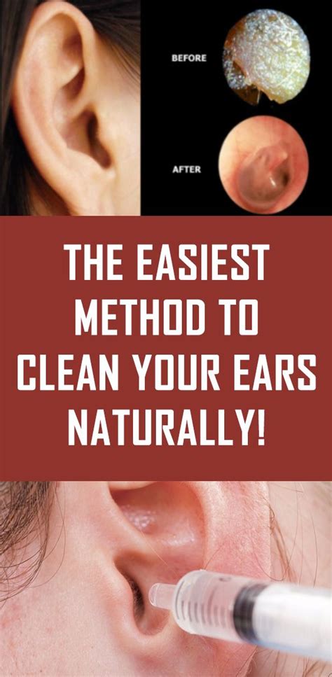 easiest method  clean  ears naturally cleaning  ears