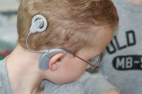 fda approves  remote feature  cochlear implant system  images cochlear implant