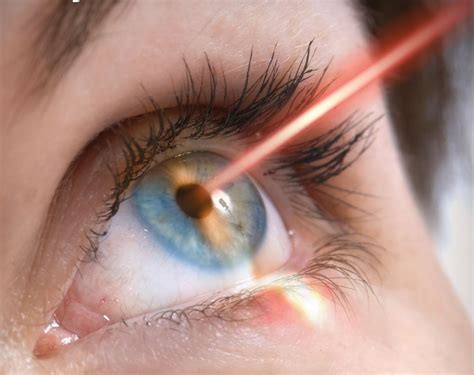 advantage  disadvantage  laser eye treatment