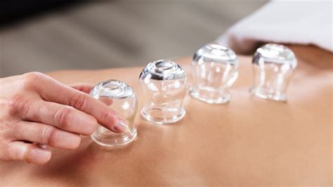 what is cupping therapy and does it actually work