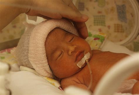 baby born   weeks  complications   care