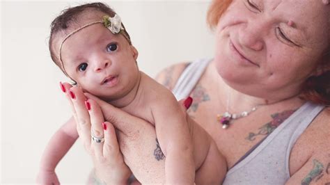 biological mom  baby born  birth defects   rejected
