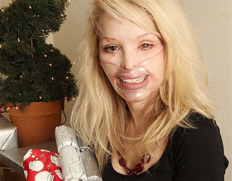 acid attack model katie piper shares a christmas message of hope after