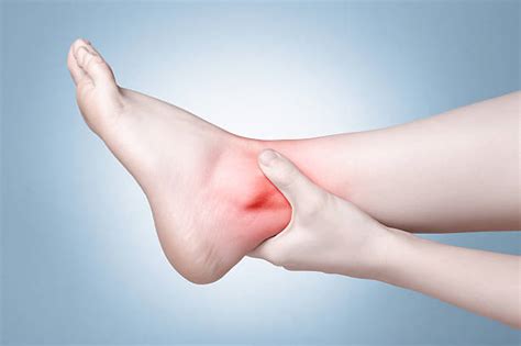 Does Plantar Fasciitis Cause Ankle Pain Wound Care Society