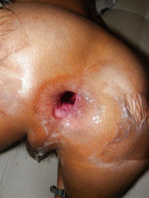 ass spread and gaping asshole 3 pics xhamster