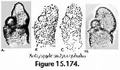 Afbeeldingsresultaten voor "botryocyrtis Scutum". Grootte: 173 x 101. Bron: www.uv.es