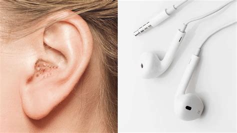 doctors warn      ears   wear headphones  long