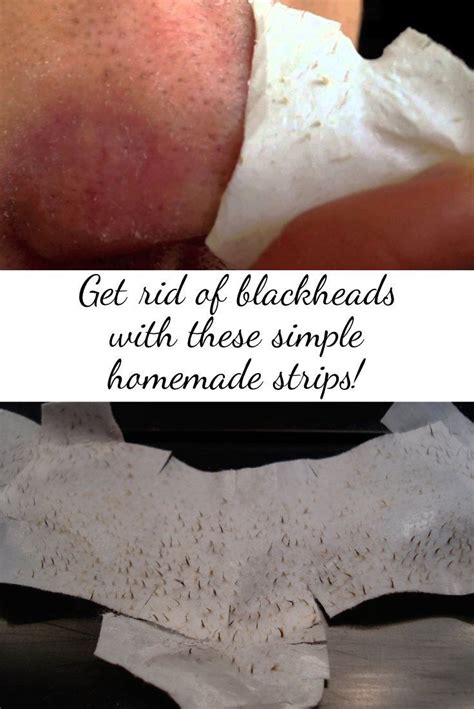 17 best images about homemade pore strips on pinterest