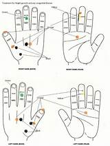 Acupressure Points Reflexology Therapy Color Hand Sujok Choose Board sketch template