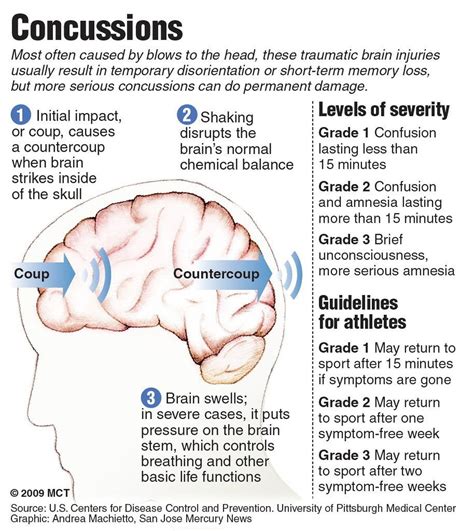 scary statistics about concussions