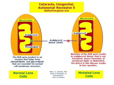 cataracts congenital autosomal recessive 5 hereditary ocular diseases
