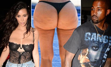 Kanye West And Kim Kardashian Fight Over Butt Plastic Surgery