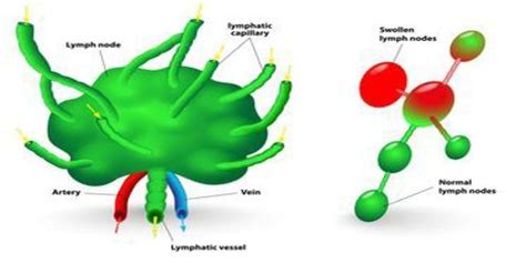 Lymph Node Assignment Point