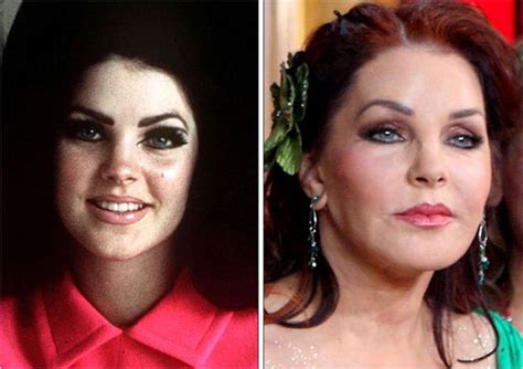 priscilla presley plastic surgery before after botox