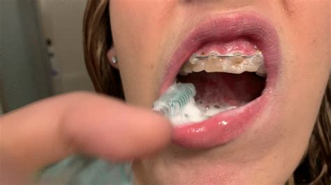 Lanas Fetish And Kink Store Brushing Teeth With Braces