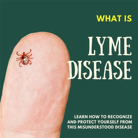 lyme disease mfasco health safety