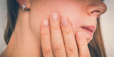 what causes canker sores symptoms causes and treatments