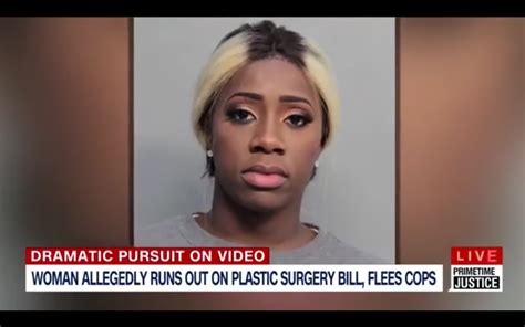 plastic surgery bill nessa on air