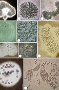 Afbeeldingsresultaten voor "Protocystis Harstoni". Grootte: 121 x 185. Bron: www.researchgate.net